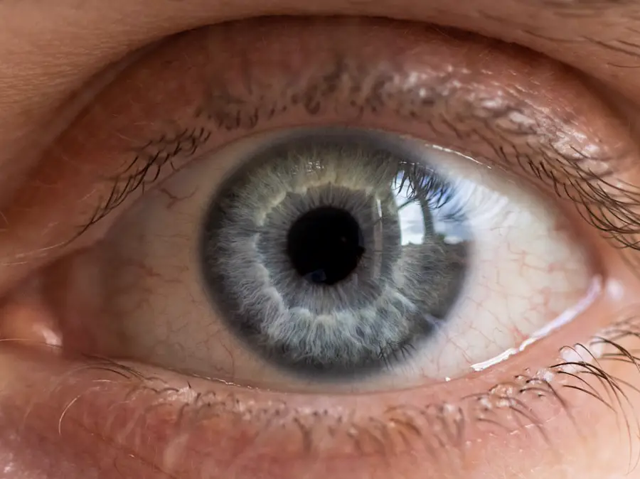 Cirugía Oculofacial